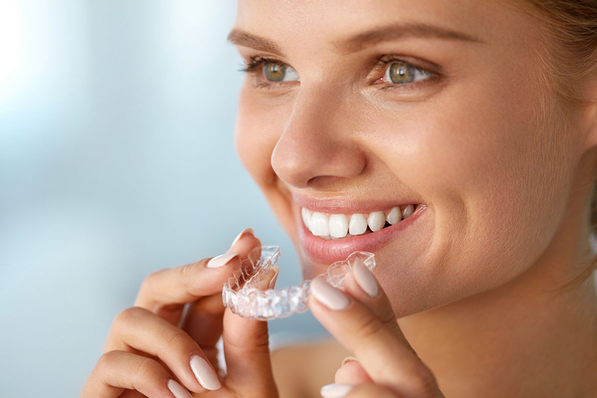 what does the invisalign process involve